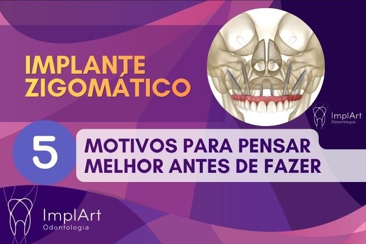 implante zigom&aacute;tico