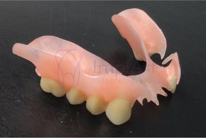 pr&oacute;tese de silicone flex&iacute;vel