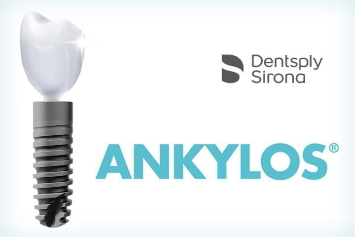 Tecnologia dos implantes Ankylos implantes Ankylos