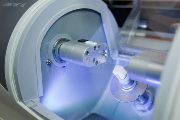 Cerec 3D - Coroas em Emax Cad Coroas em Emax
