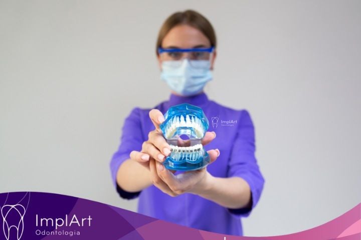 Sorriso Perfeito com Uso de Aparelho e Implante Dentário aparelho e implante