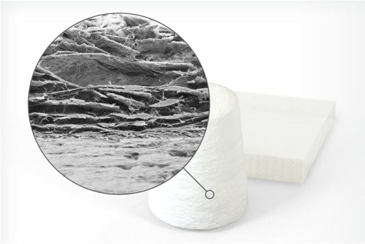 Enxerto ósseo com BMP – indução óssea molecular Enxerto ósseo com BMP