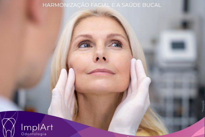 Na febre da harmonização facial, pacientes estão esquecendo de cuidar de seus dentes harmonizaçao facial