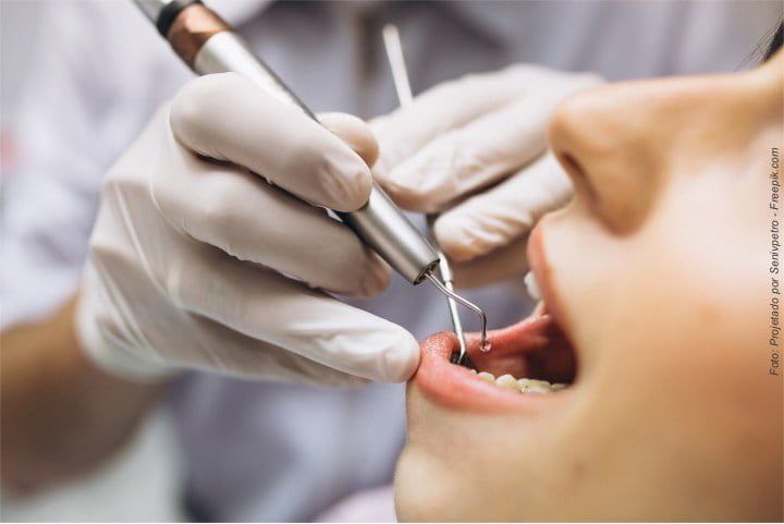 Quanto tempo dura um tratamento dentário? Quantos anos dura o implante protocolo? quanto tempo dura