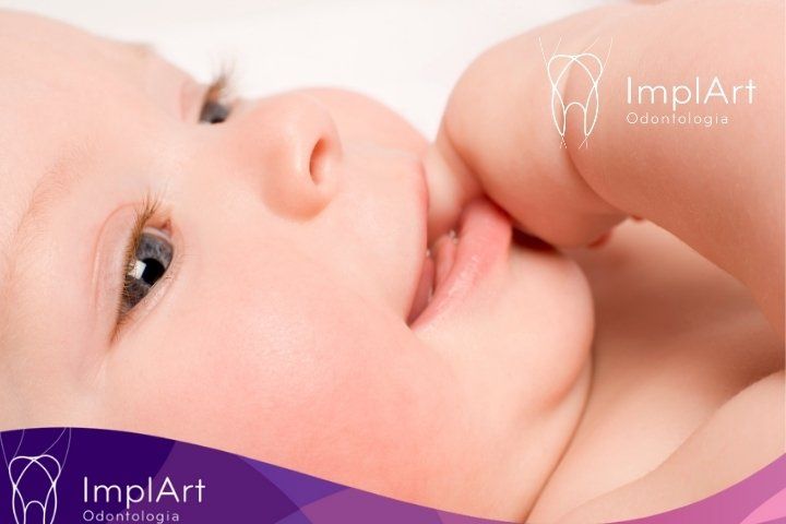 Frenectomia: Procedimento e Benefícios para a Saúde Bucal frenectomia bebe