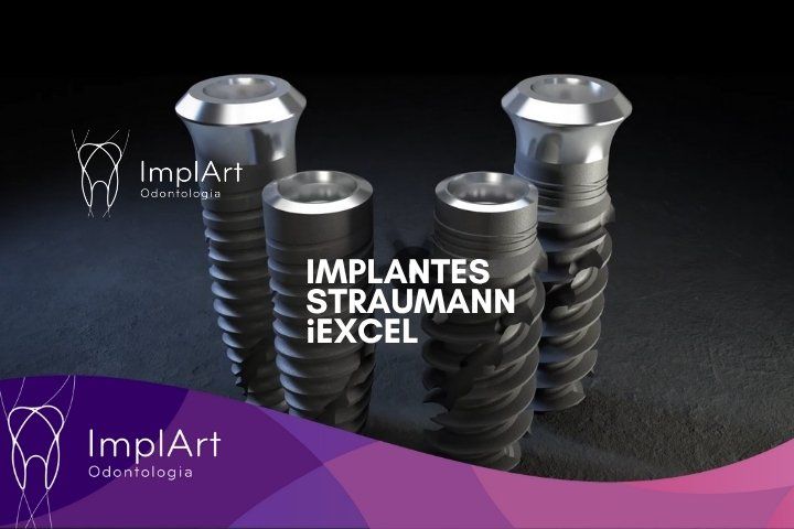 Implante Straumann iEXCEL™ A Nova Geração de Implantes Dentários na Clínica ImplArt IMPLANTE STRAUMANN IEXCEL