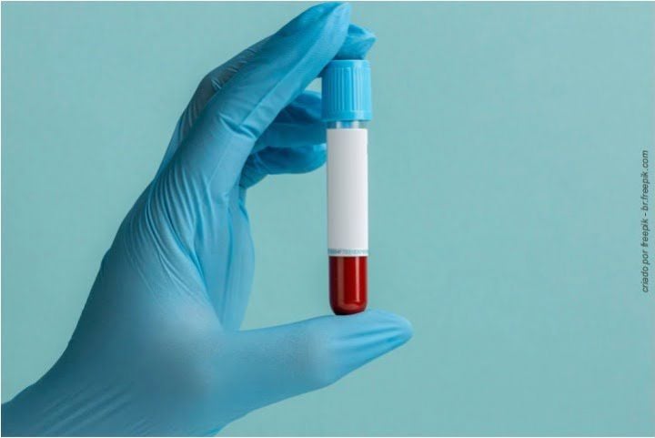 plasma rico em plaquetas