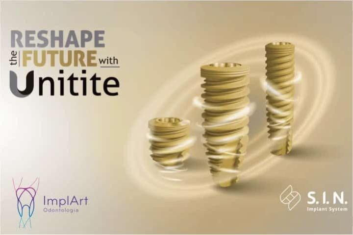 Implantes dentários SIN - Implantes nacionais de nível mundial sin